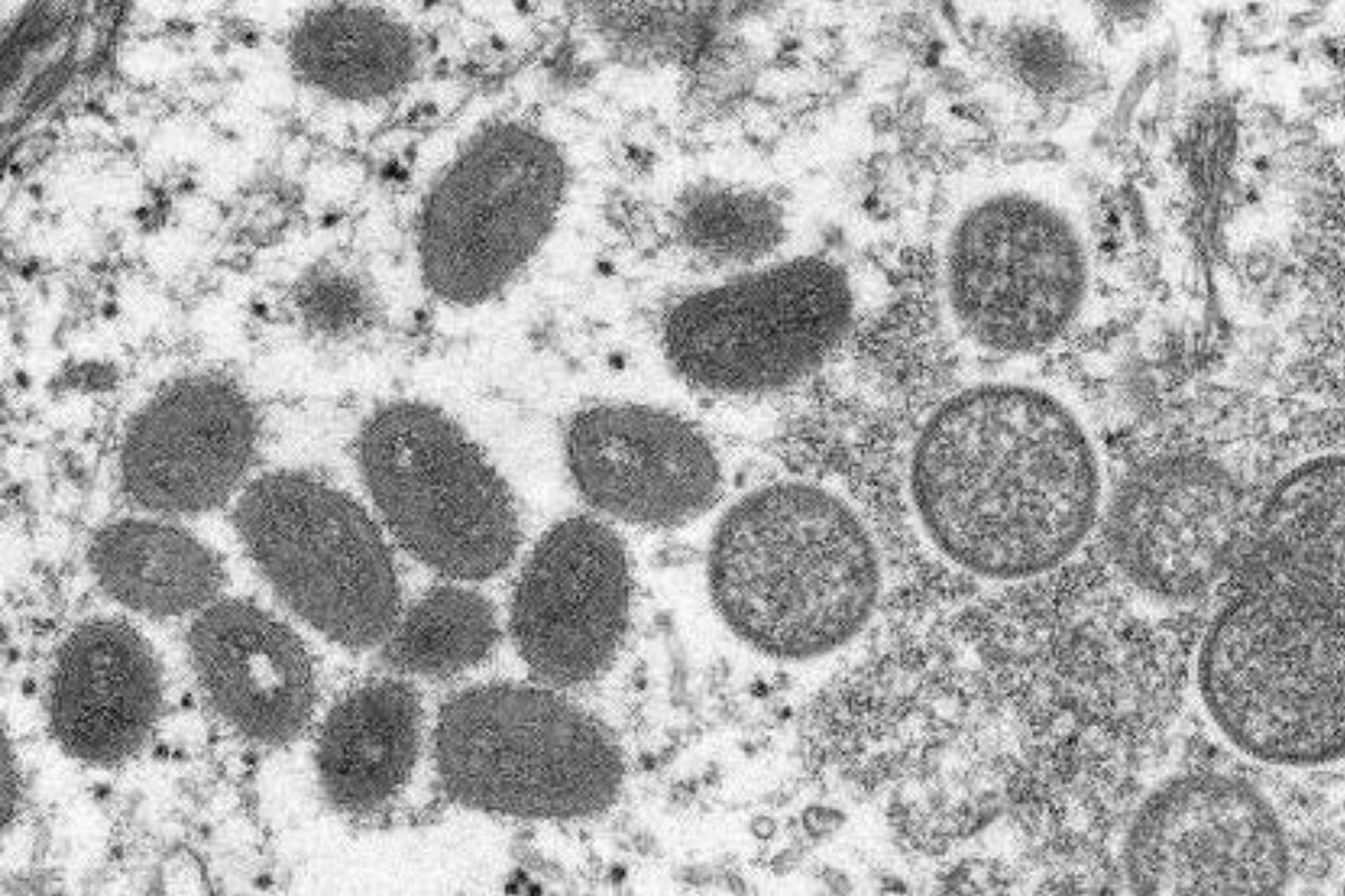 天然痘の治療薬が「サル痘」にも効果があると発表 - ナゾロジー