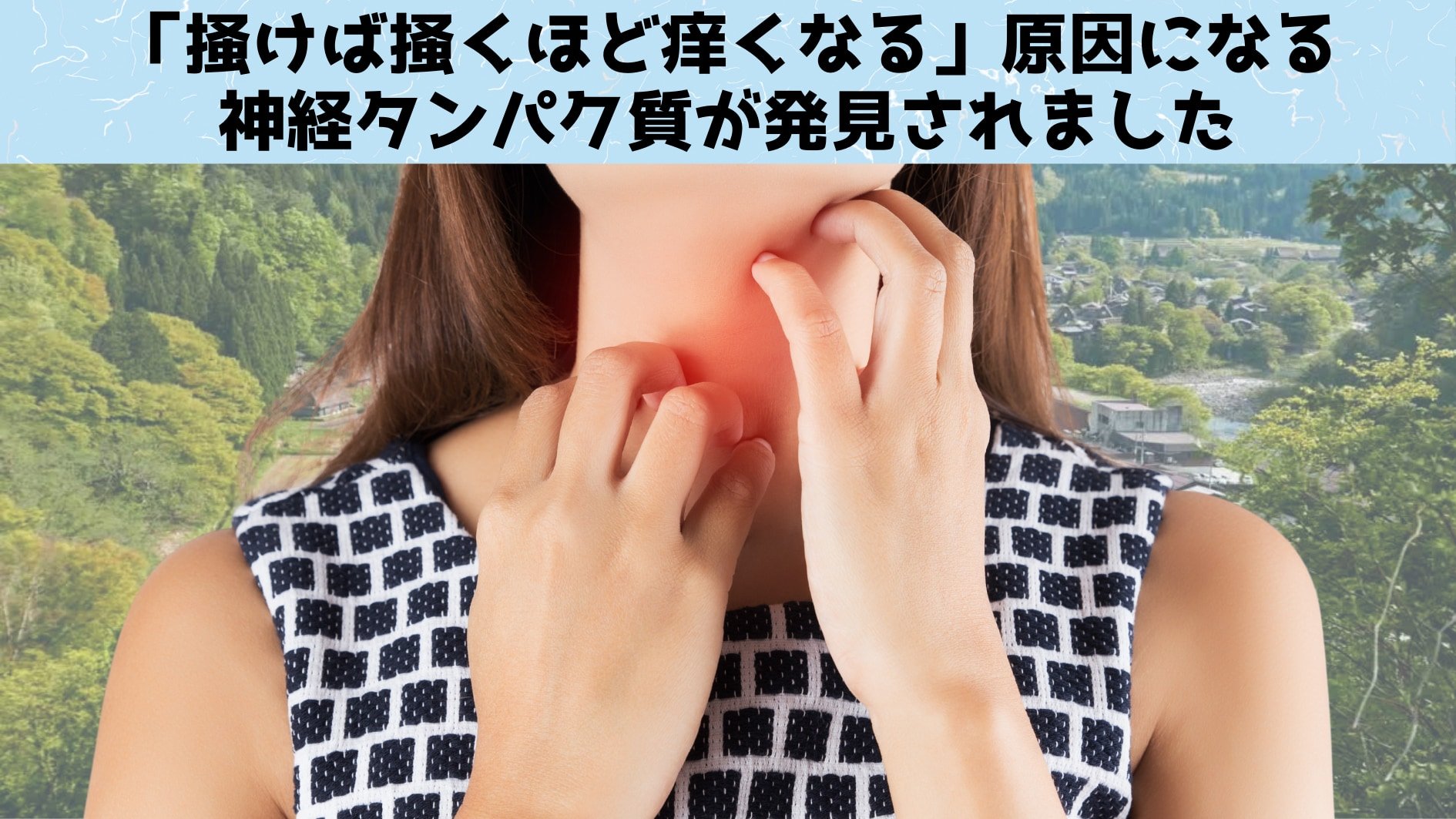 皮膚をかくと「かゆみを増加」させるタンパク質を発見！