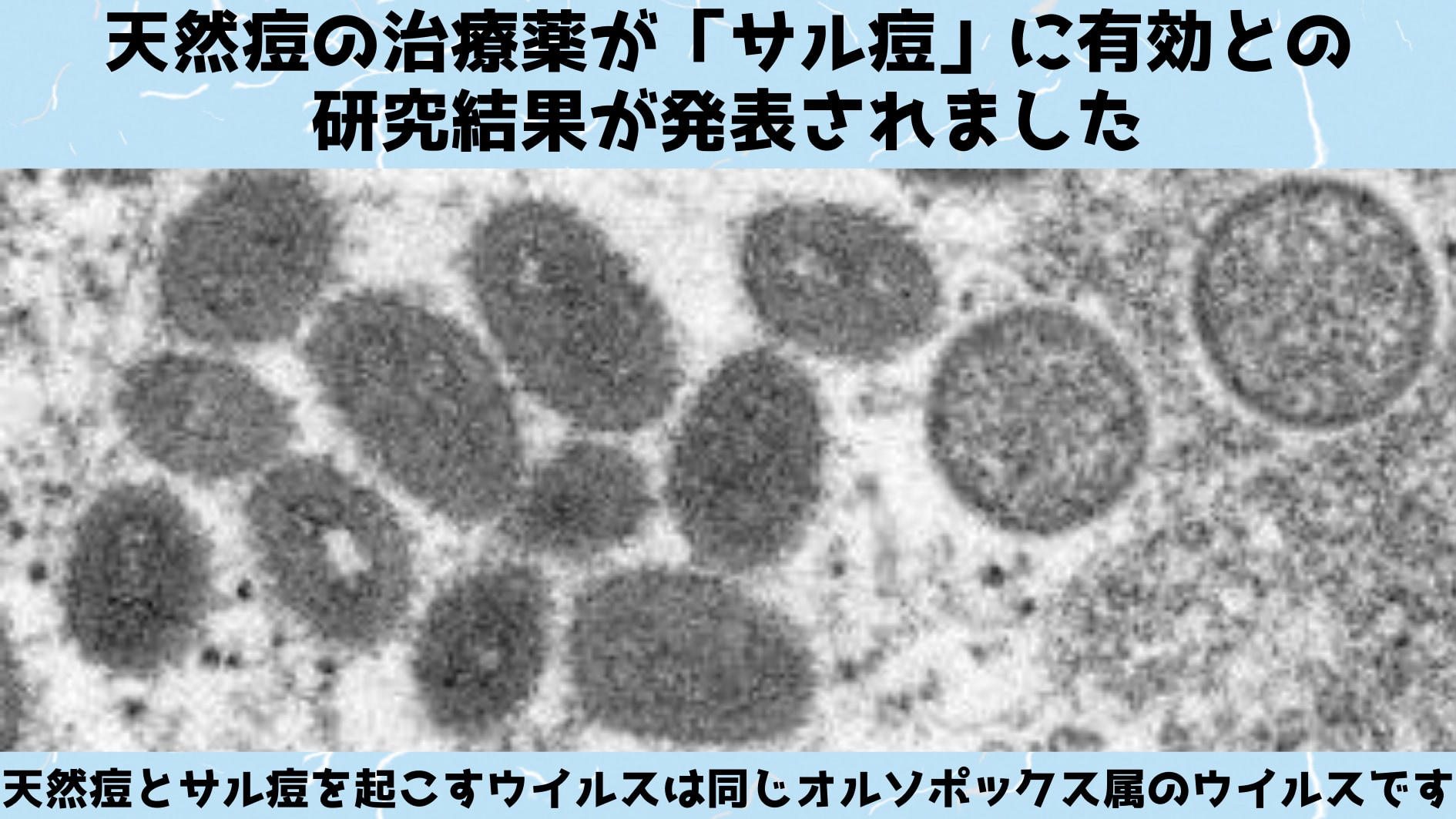 天然痘の治療薬が「サル痘」にも効果があると発表