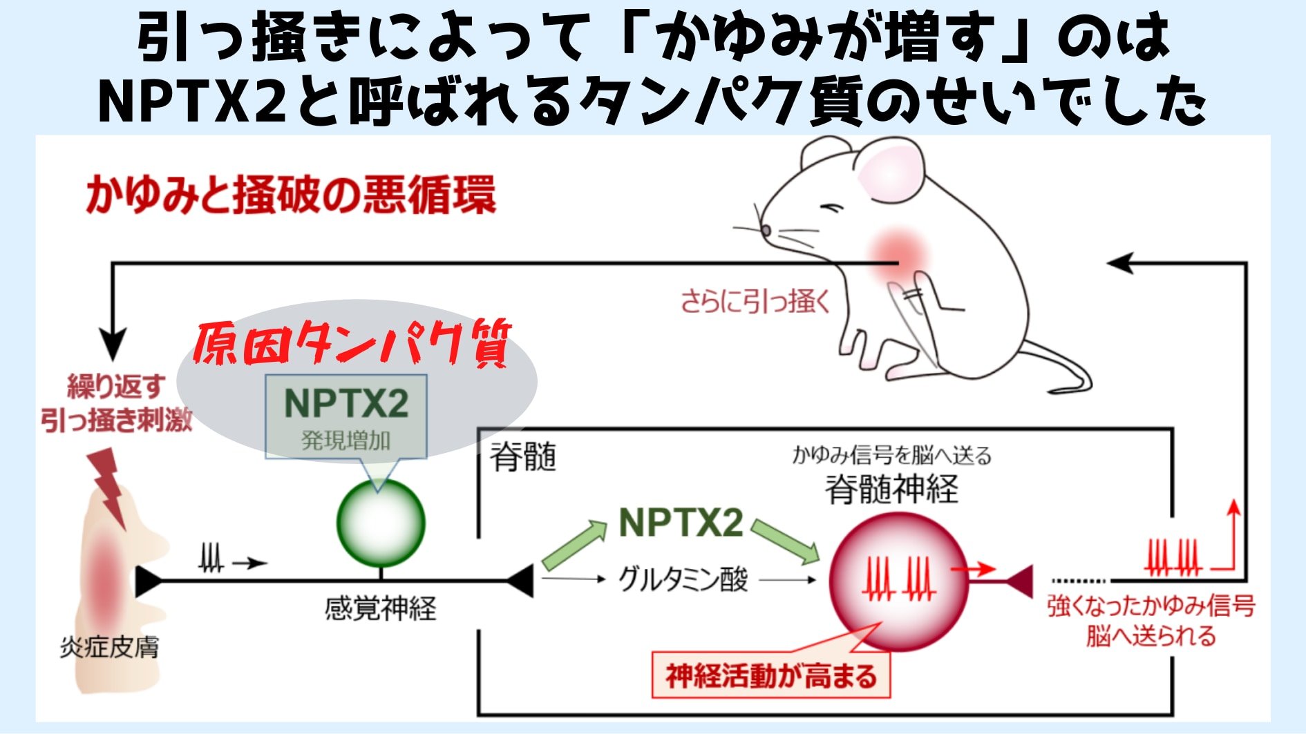 皮膚を引っ掻くと「かゆみを増す」タンパク質が生産されていた