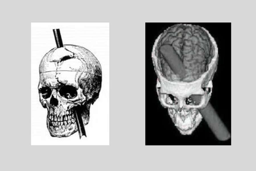 鉄の棒が貫通した模式図と再現CGI（前頭前野の大部分を損傷したという）