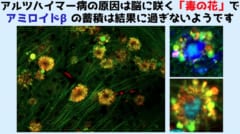 脳細胞に咲く「毒の花」がアルツハイマー病の真の原因だった！の画像 4/5