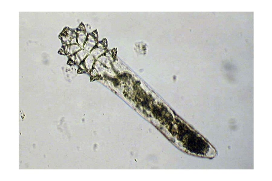 顔ダニは「人体との融合」に向けて進化し始めていた！