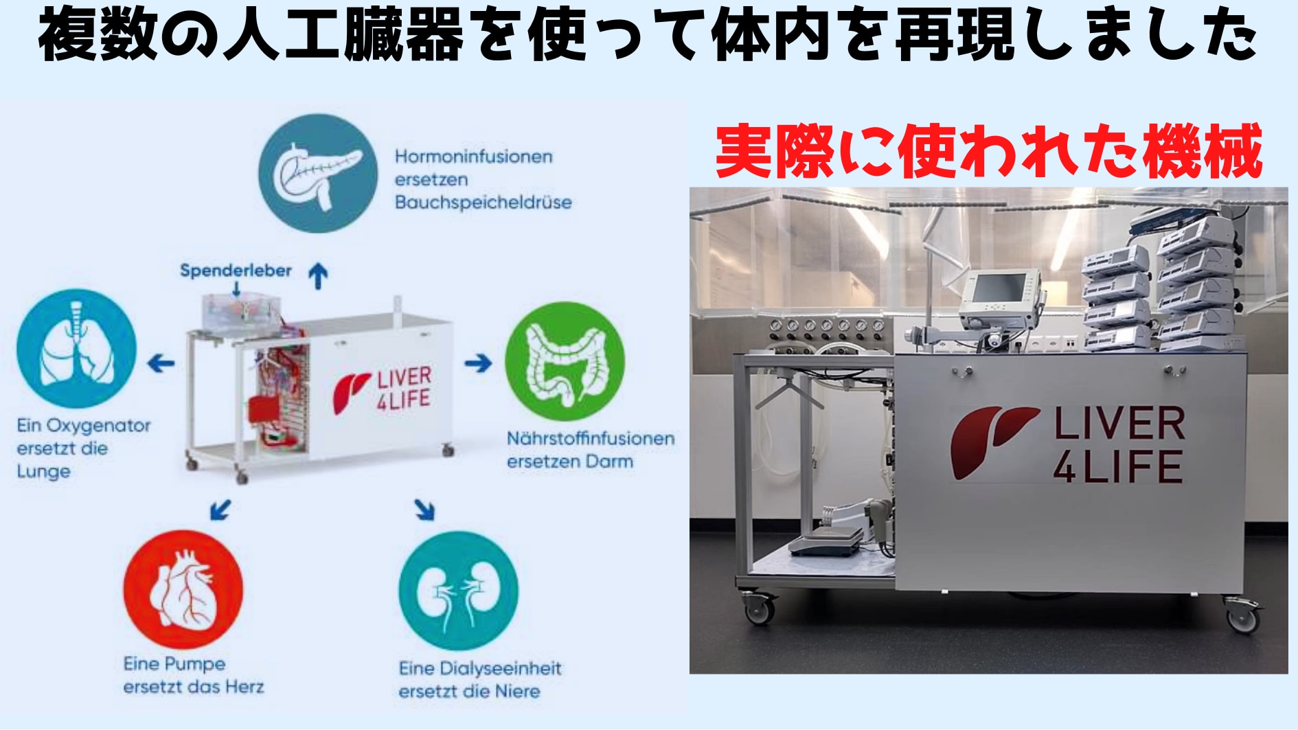 自律型人工臓器群が肝臓の長期保存を可能にする