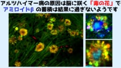 脳細胞に咲く「毒の花」がアルツハイマー病の真の原因と判明！の画像 4/5