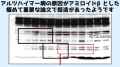 アルツハイマー病の原因をアミロイドβとする重要論文での捏造疑惑の詳細