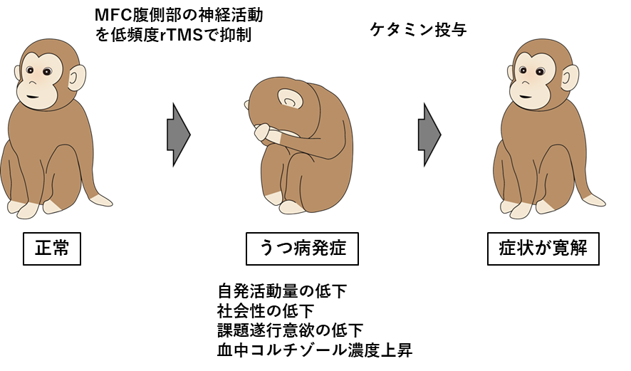世界初、磁場による脳刺激でサルを人工的に「うつ病」にすることに成功（東北大）