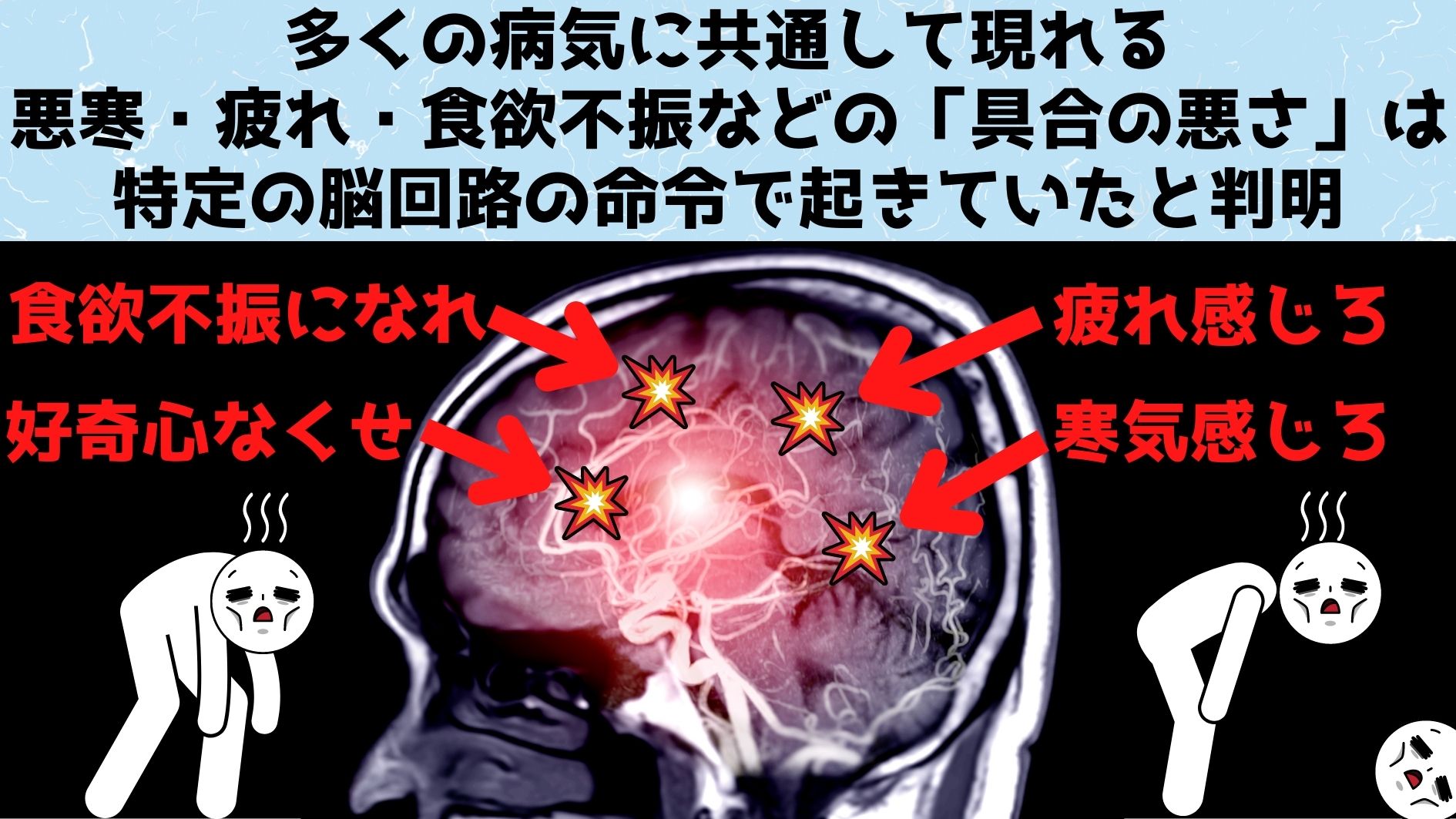 疲れや食欲不振など多くの病気に共通する症状を起こす脳回路を発見！