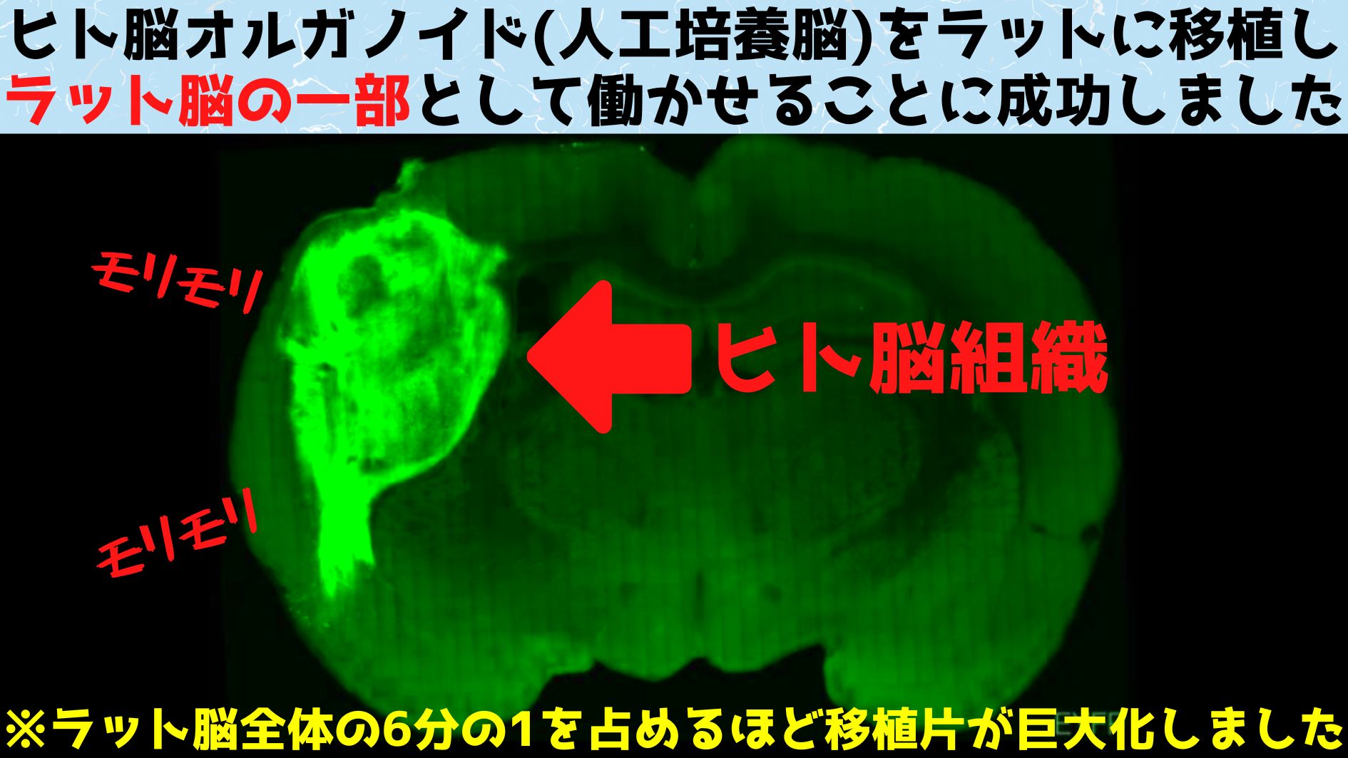 ヒト脳オルガノイドをラット脳に移植し接合することに成功！