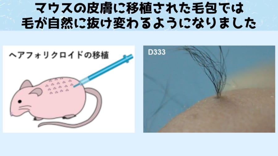 人工培養された毛包は移植後に自然な抜け変わりをするようになる