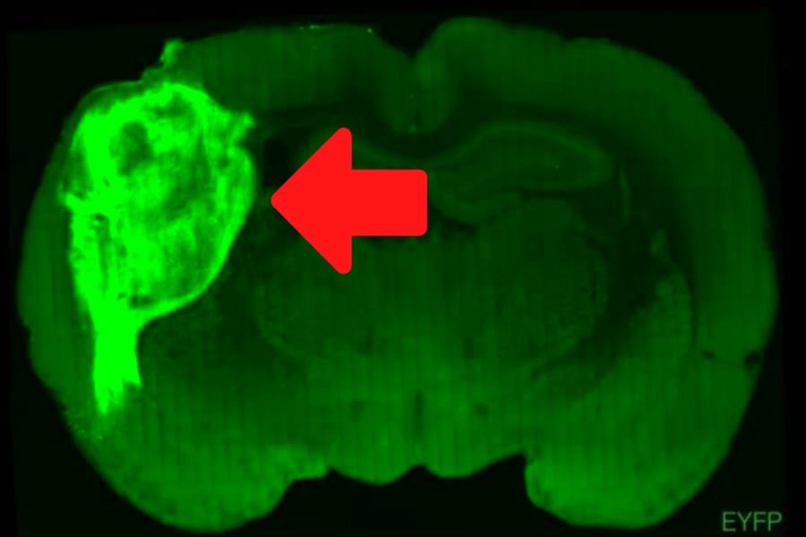 ヒト脳オルガノイドをラット脳に移植し接合することに成功！