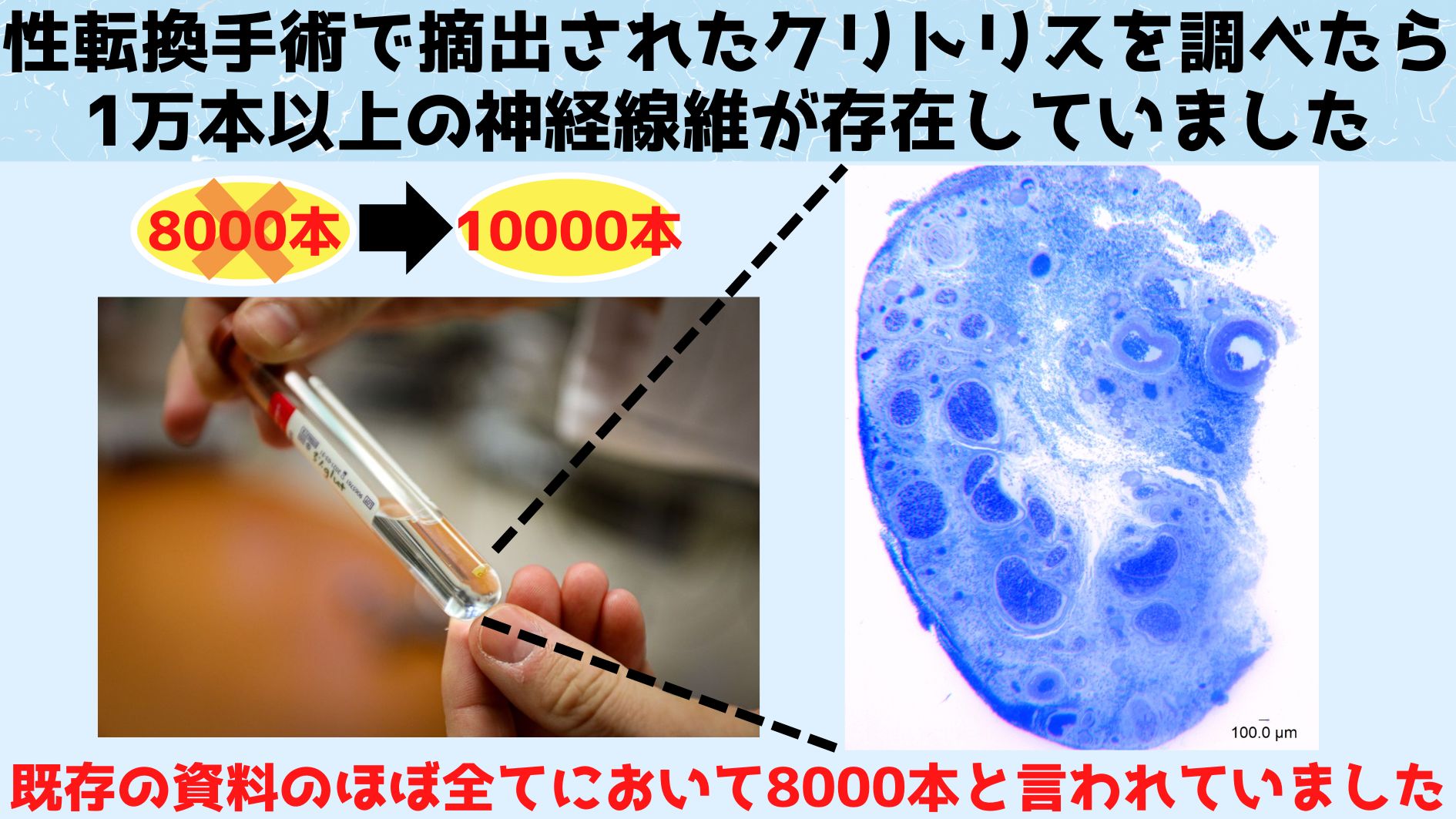 人間のクリトリスの神経線維を初めて数えた結果1万本以上あることが判明！の画像 1/3