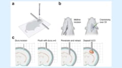 赤ちゃんラットの頭蓋骨を切り開いてヒト脳組織を注入する操作