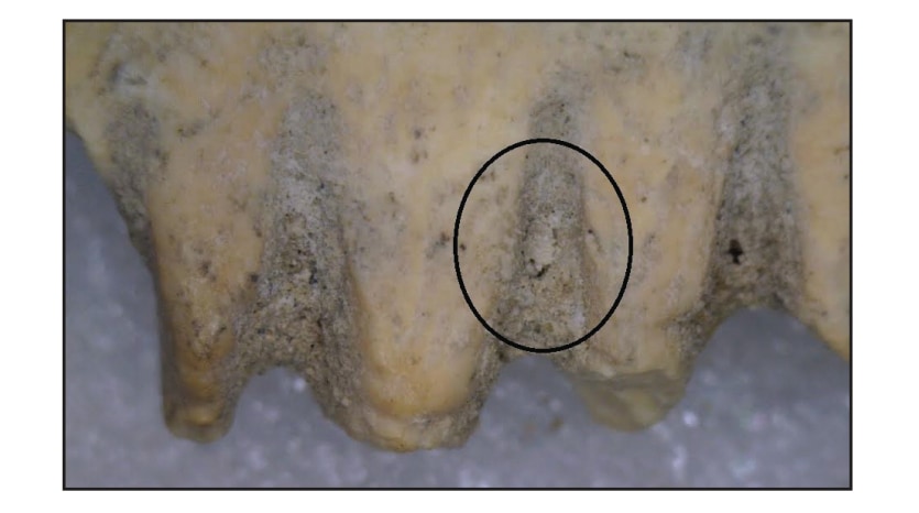 櫛の間にシラミの残骸を発見