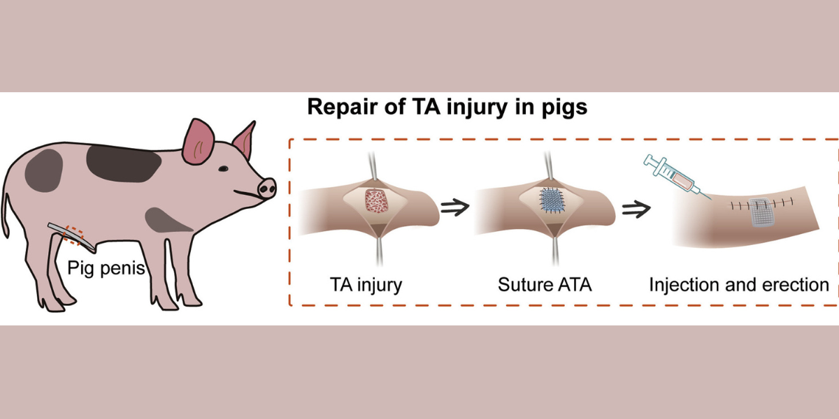 人工組織でブタの「勃起不全」の治療に成功！