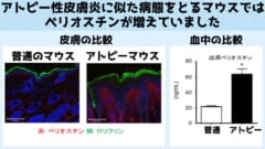 アトピー性皮膚炎に似た病態をとる遺伝子組み換えマウス（アトピーマウス）の皮膚と血中ではペリオスチンと呼ばれるタンパク質が増えていた