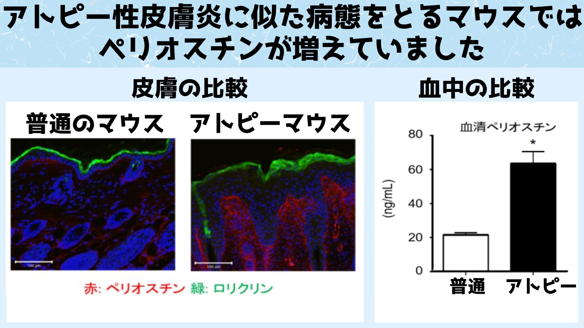 アトピー性皮膚炎に似た病態をとる遺伝子組み換えマウス（アトピーマウス）の皮膚と血中ではペリオスチンと呼ばれるタンパク質が増えていた