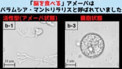 日本の青森県の土壌から採取されたB. mandrillarisの画像