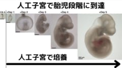 人工子宮技術が急速に進歩し、受精卵さえあれば胎児の段階にまで子宮外で育てることができる