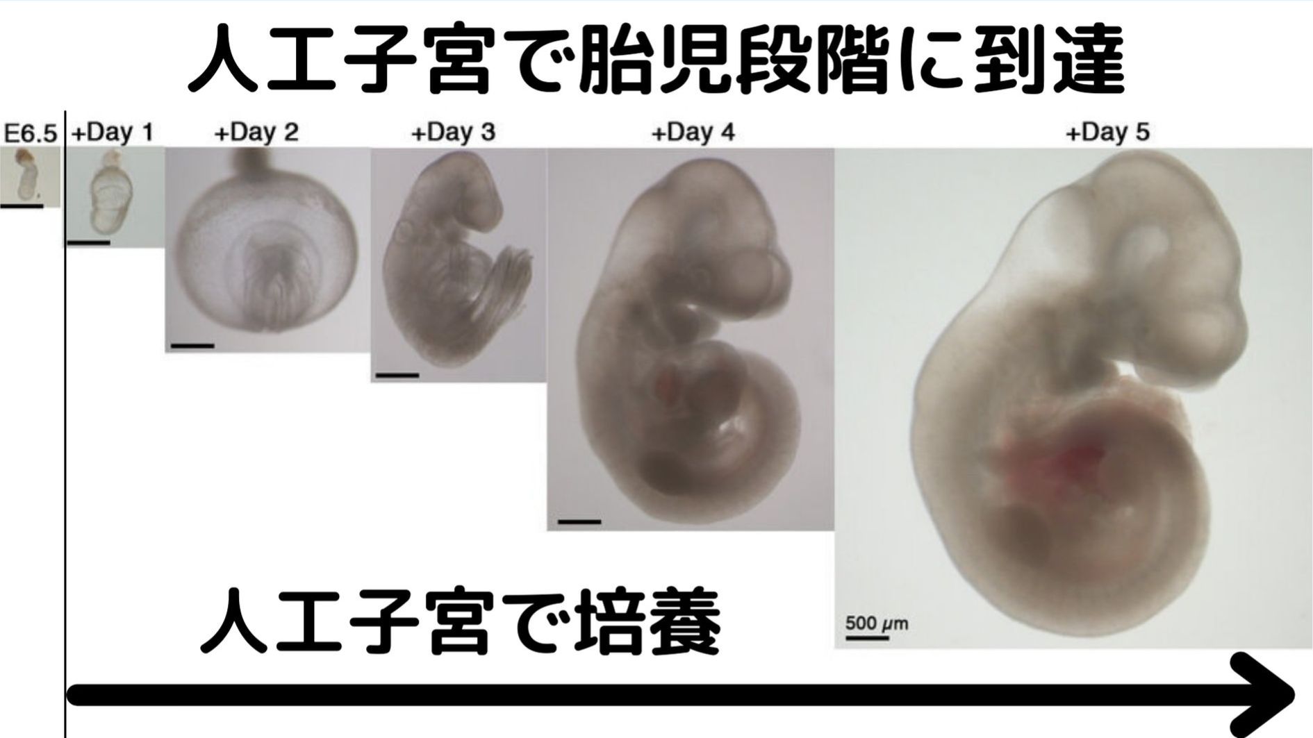 人工子宮技術が急速に進歩し、受精卵さえあれば胎児の段階にまで子宮外で育てることができる