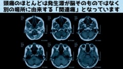 脳は痛みを感じないのに、なぜ頭痛がするのか？