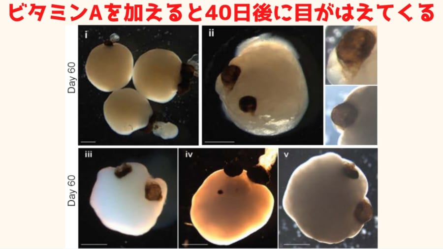 幹細胞技術の進歩により、人間の脳を培養できるようになりました