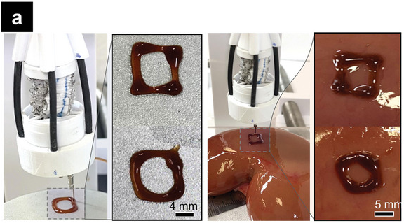 生体材料を臓器に直接プリントすることに成功。細胞は1週間で4倍に増殖した。