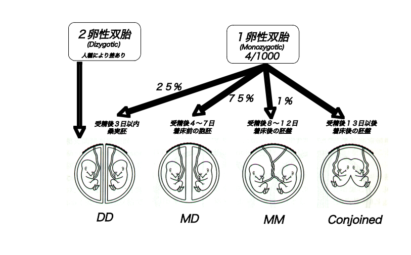 双胎妊娠のタイプ