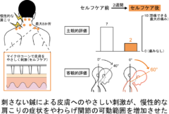 皮膚への「やさしい刺激」で首・肩こりが緩和