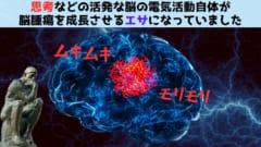 思考自体が脳腫瘍の増殖を促進していると判明！