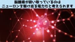 思考自体が脳腫瘍の増殖を促進していると判明！