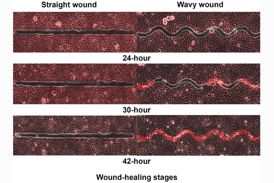 直線より「波型の傷口」の方が5倍早く治る！不思議なメカニズムを解明！