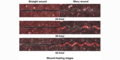 真っ直ぐより「クネクネした傷口」の方が5倍も早く治りやすいと判明！