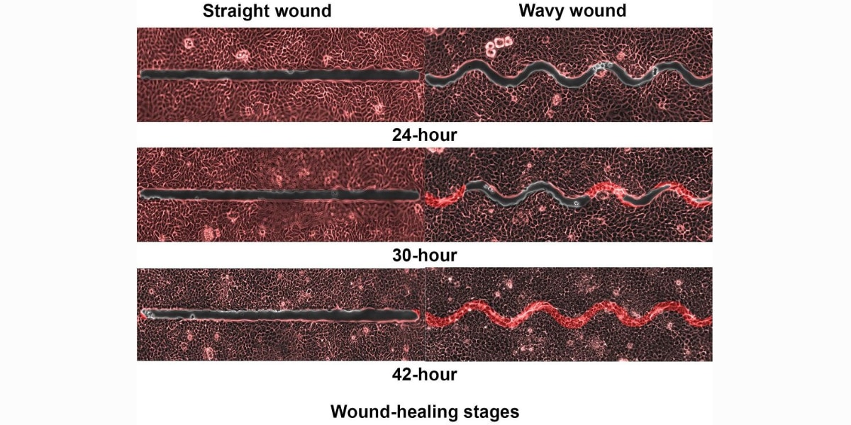 真っ直ぐより「クネクネした傷口」の方が5倍も早く治りやすいと判明！