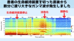 臨死体験の正体は死ぬ間際の「爆発的な脳活動」だった