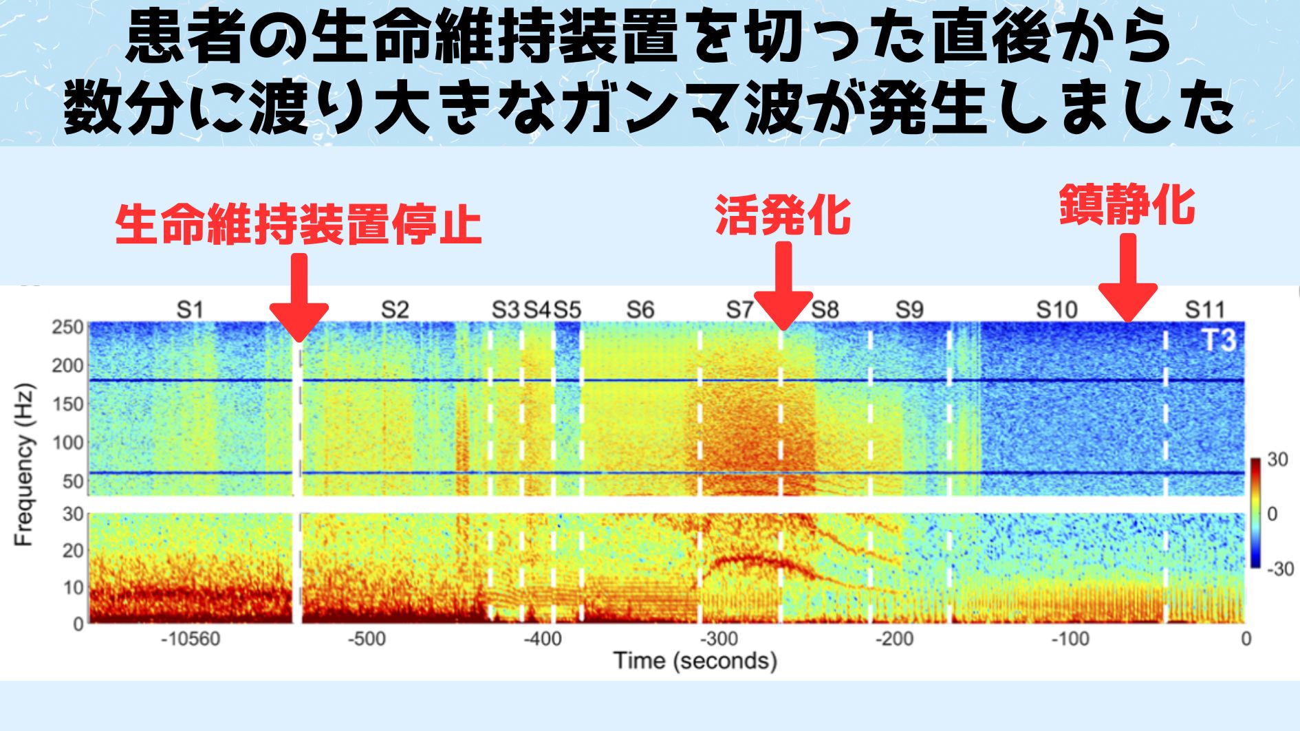 臨死体験の正体は死ぬ間際の「爆発的な脳活動」だった