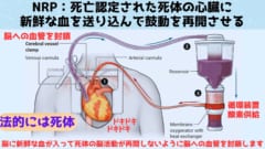 死亡認定した人体で5分後に心臓を再起動する