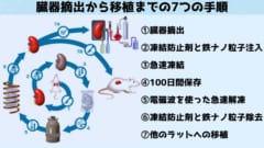 摘出から移植までの７手順