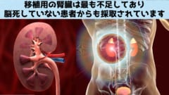 脳死男性に移植した「豚の腎臓」が1カ月以上働いていると判明！