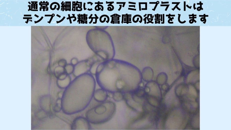 じゃがいもの細胞内にあるアミロプラスト