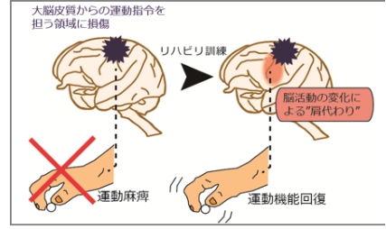 脳は損傷しても機能を肩代わりする箇所がある