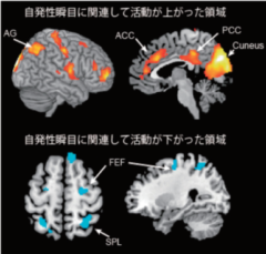 上：瞬きをすると活動が上がる領域　下：瞬きをすると活動が下がる箇所