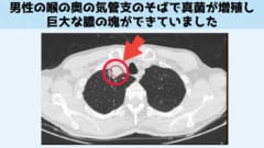 界をまたぐ感染能力が本物ならば地球生命全てが感染対象になり得る