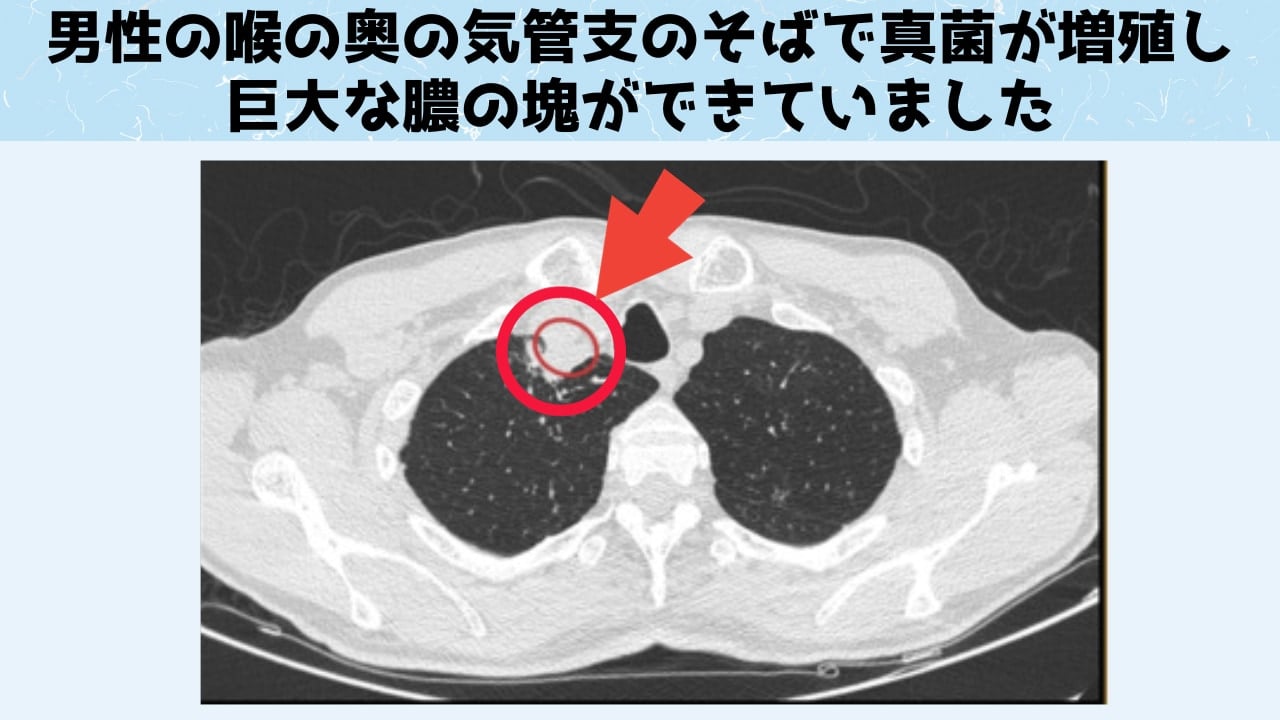 界をまたぐ感染能力が本物ならば地球生命全てが感染対象になり得る