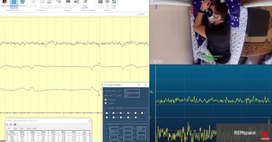 明晰夢を見ている被験者と記録された筋電図（EMG）