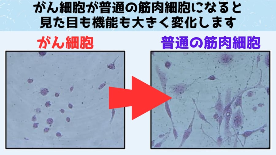 がん細胞から筋肉細胞の変化で見た目も大きく変わりました