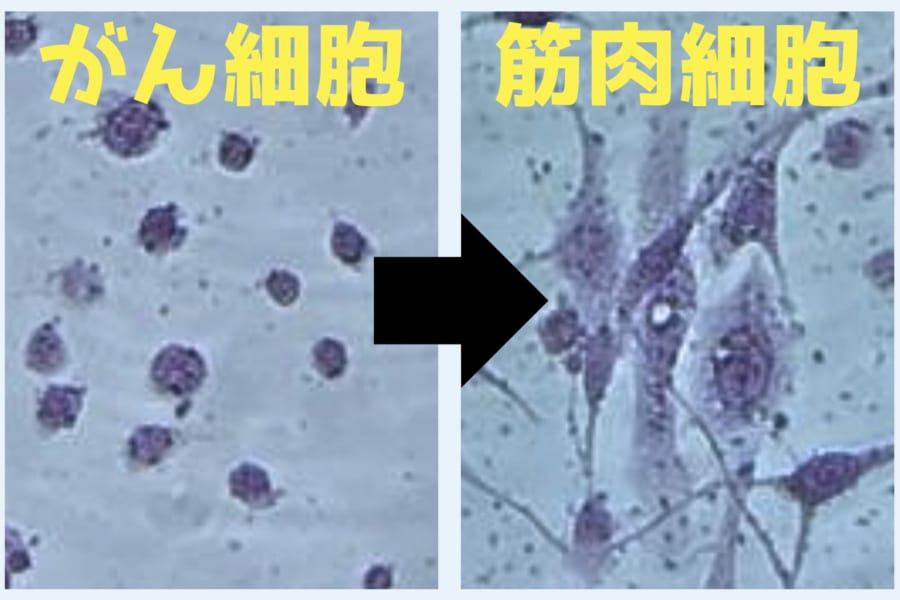 がん細胞を「普通の細胞」に転職させる新たな方法を開発！