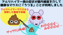 アルツハイマー病の症状が「うつる」仕組み