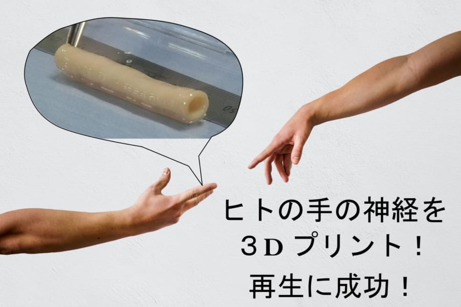 ヒトの神経を3Dプリントし移植後に「知覚を回復」させることに成功！