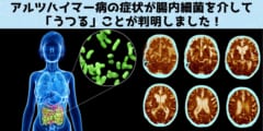 アルツハイマー病の症状が腸内細菌を介して「うつる」ことが判明！の画像 1/5